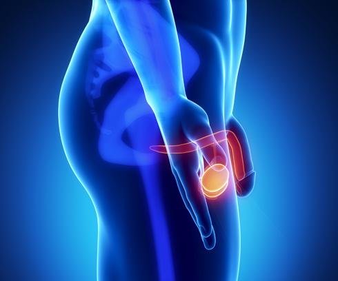 Pene. Fotos Urología. Plusesmas.com