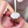 Dientes nuevos: implantes en 24 horas