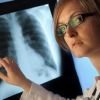 Síntomas y tratamiento dela embolia pulmonar