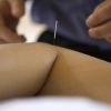 Causas más frecuentes de dolor en el codo