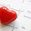 ¿Qué relación existe entre las enfermedades cardiacas y las enfermedades cerebrovasculares?