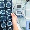 ¿Qué riesgo tengo yo de padecer Alzheimer? ¿Es hereditario?