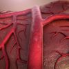 Arteria de la temporal, arteritis de células gigantes y polimialgia reumática