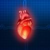 Aneurismas de aorta torácica y abdominal: causas y tratamiento