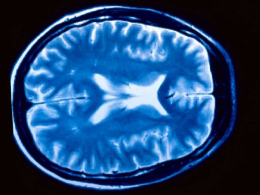 ¿Cómo afectan los estímulos al cerebro?