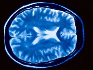 ¿Cómo afectan los estímulos al cerebro?