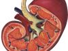 Detección y tratamiento del cáncer de riñón