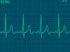 Electrocardiograma