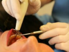 ¿De qué medios dispone el dentista para cuidar o curar la dentadura?