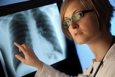 Embolia Pulmonar Trombosis Pulmonar Sintomas Y Tratamiento
