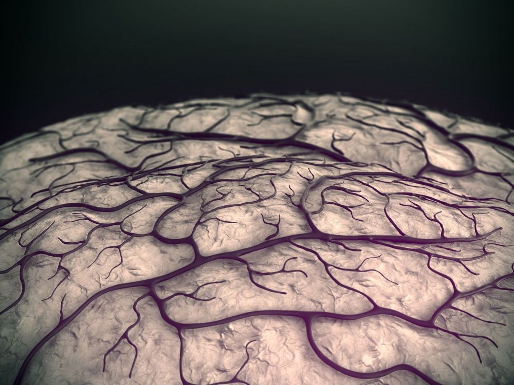 Perdida de peso y arteritis temporal