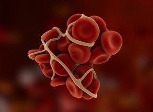 Resultado de imagen para Coagulación o hemostasia: