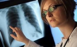 Síntomas y tratamiento dela embolia pulmonar