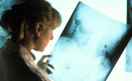Qué es la fibromialgia