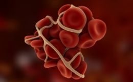 Coagulación (Hemostasia y Trombosis)