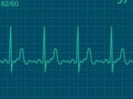 Electrocardiograma