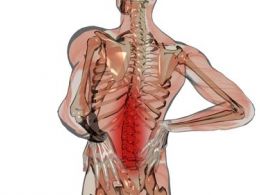 Preguntas frecuentes sobre el dolor lumbar