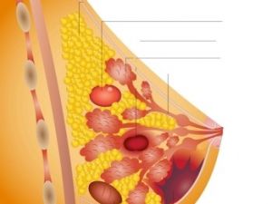 Estudio y tratamiento del cáncer de mama