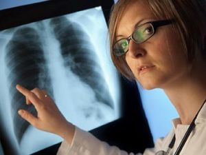 Síntomas y tratamiento dela embolia pulmonar