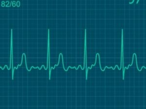 Electrocardiograma