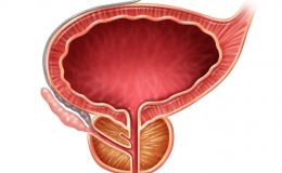 Hiperplasia o adenoma de próstata: causas, síntomas y tratamientos