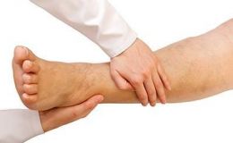 Piernas hinchadas: cómo tratarlas