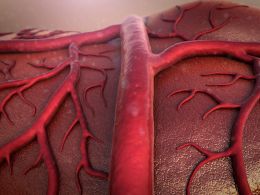 Arteria de la temporal, arteritis de células gigantes y polimialgia reumática