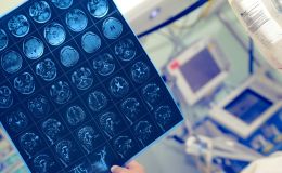 ¿Por qué se produce un derrame cerebral?