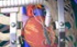 ¿Cómo es la intervención para colocar un bypass?