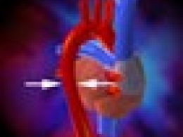 ¿Qué es la enfermedad cardíaca congénita?