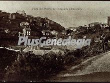 Ver fotos antiguas de vista de ciudades y pueblos en ORTIGUERA