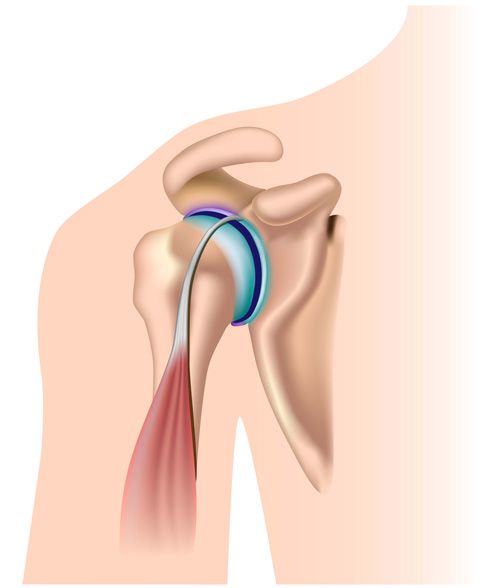 Acromion