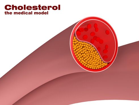 Colesterol