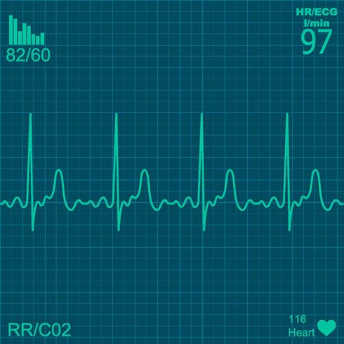 Electrocardiograma