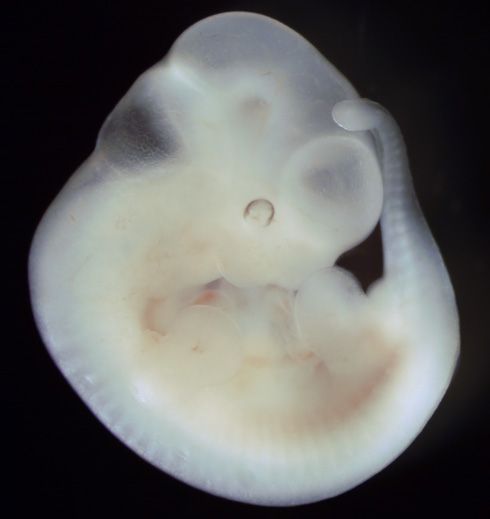 Embrion de un mes