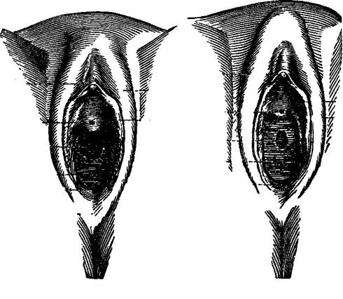 Clítoris y vulva