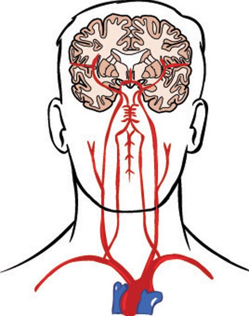 Arterias cerebrales