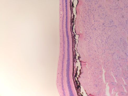 Retina al microscopio