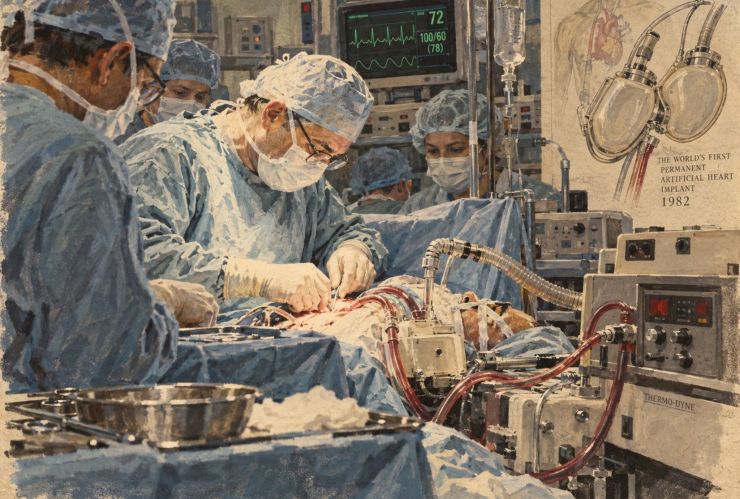 Se implanta el primer corazón artificial permanente